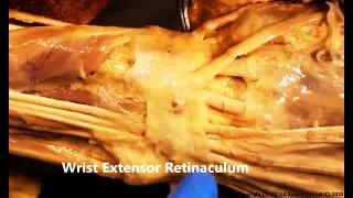 WRIST EXTENSOR RETINACULUM Compartments Tendons SNUFFBOX Clinicals – Sanjoy Sanyal – Proceum