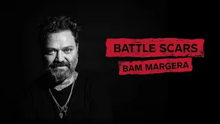 Bam Margera Battle Scars | Worst Injury Stories