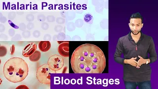 How to Identify & differentiate malaria parasites | Thin blood smear examination