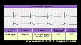 ECG Sinus, Atrial, Junctional Rhythms