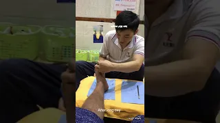 feet massage at china