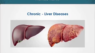 Chronic Liver Disease | Gastrointestinal Disorders | EduRx