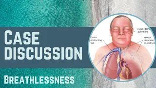 Case Discussion || Breathlessness