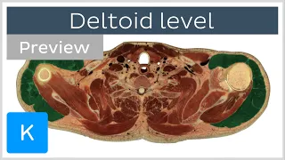 Cross section at the level of the deltoid muscle (preview) - Human Anatomy | Kenhub