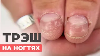 What's wrong with the nails?😨 Nail transformation and extension