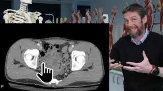 Male pelvis transverse CT imaging