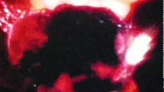 Blood blob 1