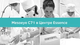 Mesoeye С71 в Центре ESSENCE