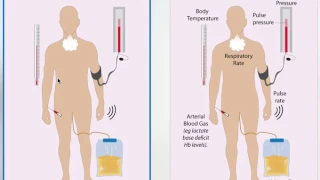 Trauma Part 9 - Assessing Adequacy of Resuscitation