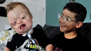 Raedyn's Unique and Fun Life (Pfeiffer Syndrome)