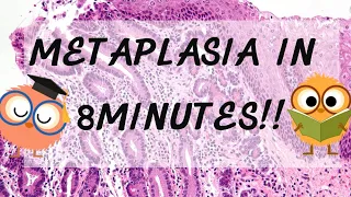 Metaplasia Pathology in 8 Minutes!!