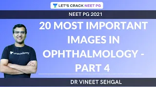 20 Most Important Images in Ophtha -Part 4 |  NEET-PG 2021 | Vineet Sehgal