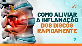 COMO DESINFLAMAR OS DISCOS DA COLUNA - DICAS E EXERCÍCIOS - Fisioprev