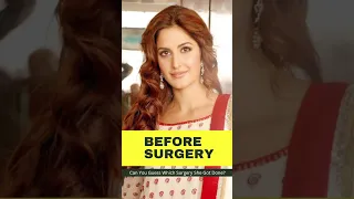 Katrina Kaif: Can You Guess Which Surgery She Got Done? | Bollywood News | Her Zindagi #shorts