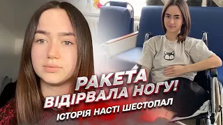 Війна відірвала їй ногу! Історія Насті Шестопал, яка вижила після трагедії у Краматорську