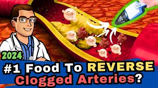 #1 Food to Clean out Your Arteries? [Blood Clots & Arteriosclerosis]