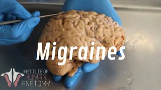 What Are Migraines?