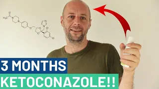 Ketoconazole Shampoo Experiment! As Good As Minoxidil?