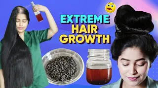 😱 I Applied This On My Bald Scalp For Unstoppable Extreme Hairgrowth गंजे सर पर बाल उगाने का नुस्खा