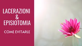 LACERAZIONI & EPISIOTOMIA | Come evitarle