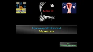 Gynecological Ultrasound -Lecture 03 -Myometrium