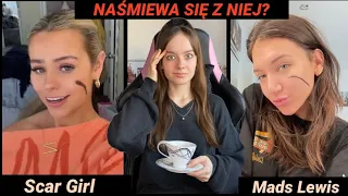 Mads Lewis NAŚMIEWA SIĘ Z TRAUMY I BLIZNY TEJ TIKTOKERKI?!? 😱