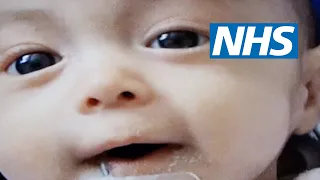 Having a child with Edwards' syndrome (trisomy 18) | NHS