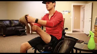 Fitting/Explaining My Amputation & Computerized Prosthetic!