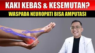 Diabetes Wajib Waspada Kaki Kesemutan Kebas Terbakar. Komplikasi Neuropati Bisa Amputasi