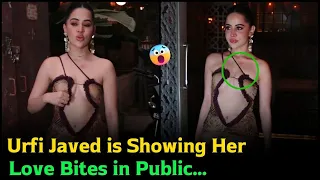 Urfi Javed is Showing Her Love Bites in Public