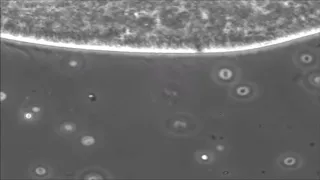 High-speed Video Microscopy of  P. caudatum cilia