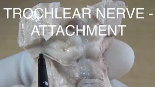Trochlear nerve - Attachment at brainstem