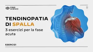 3 esercizi per la tendinopatia acuta di spalla