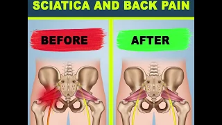 15 Minute Yoga for Sciatica and Back Pain