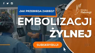 EMBOLIZACJA ŻYLNA - jak przebiega zabieg?