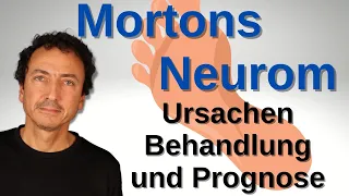 Mortons Neurom – Ursachen, Behandlung und Prognose