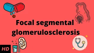 Focal Segmental Glomerulosclerosis, Causes, Signs and Symptoms, Diagnosis and Treatment.