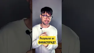 Опыт применения финастерида: ожидания и реальные результаты #пересадкаволос #красавчик #финастерид