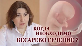 Когда кесарево сечение неизбежно?