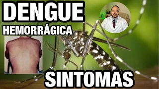 SINTOMAS DA DENGUE HEMORRÁGICA