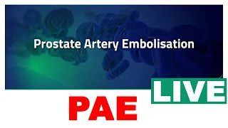 Prostate Artery Embolization Live Procedure Video Review By Dr Shaileshkumar in India