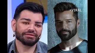 EL ARGENTINO QUE SE OPERÓ Y QUEDÓ IGUAL QUE RICKY MARTIN🤯