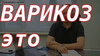 Варикоз это что такое? | медицинские термины простыми словами