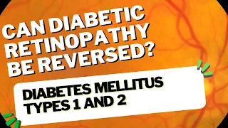 Can Diabetic Retinopathy Be Reversed?