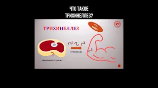 Что такое трихинеллез? #трихинеллы #трихинеллез #глисты #мясо