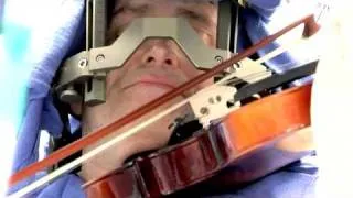 Deep Brain Stimulation - Awake Surgery - Mayo Clinic
