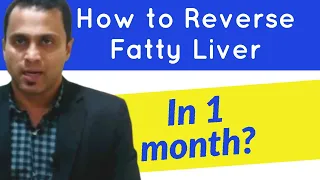 How to reverse fatty liver easily- Foods to avoid a fatty liver - How to cleanse fatty liver