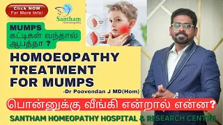 பொன்னுக்கு வீஙகி என்றால் என்ன?/ Mumps கட்டியை கண்டு பயப்படவேண்டுமா ? அதன் அறிகுறி என்ன? HOMOEOPATHY