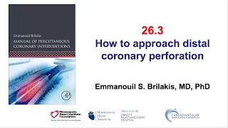 26.3 Manual of PCI - Distal vessel perforation