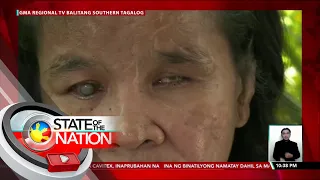 Kasambahay, nabulag dahil umano sa pangmamaltrato ng amo | SONA